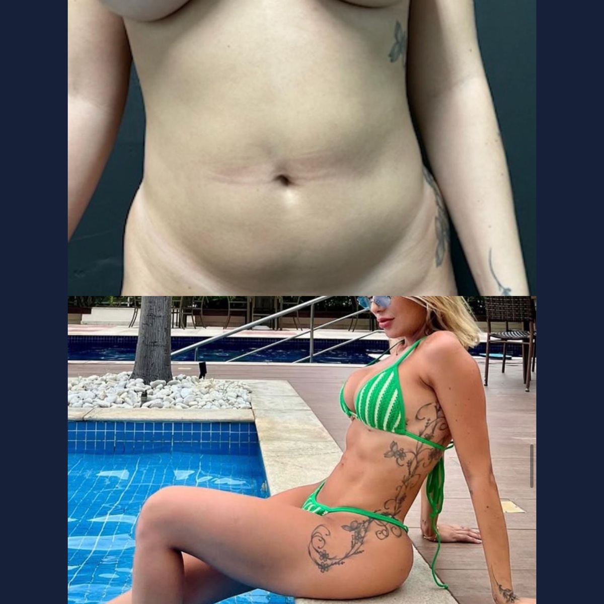 Antes e depois — caso 6